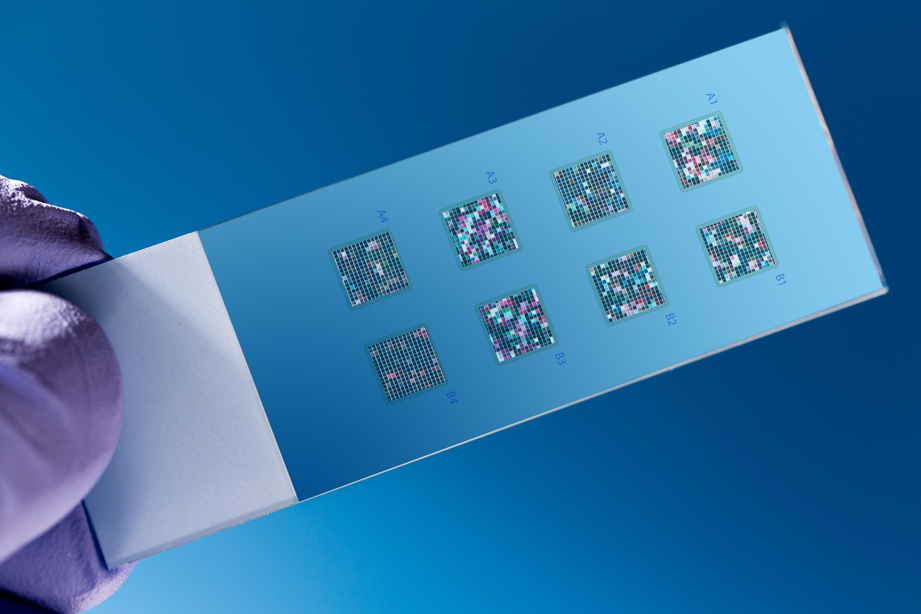 Next-Generation Genome Sequencing