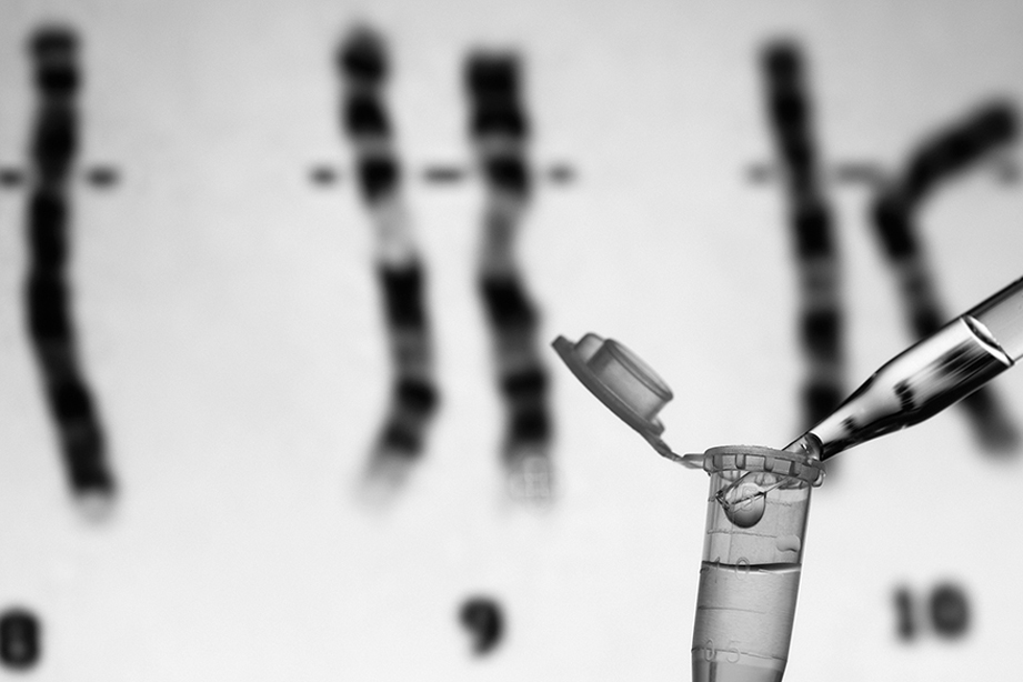 The Promise of Epigenetics as a Novel Tool for FASD Screening